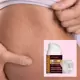 Spetsiaalne venitusarmide vastane koostis – ANTI STRETCH (x2)